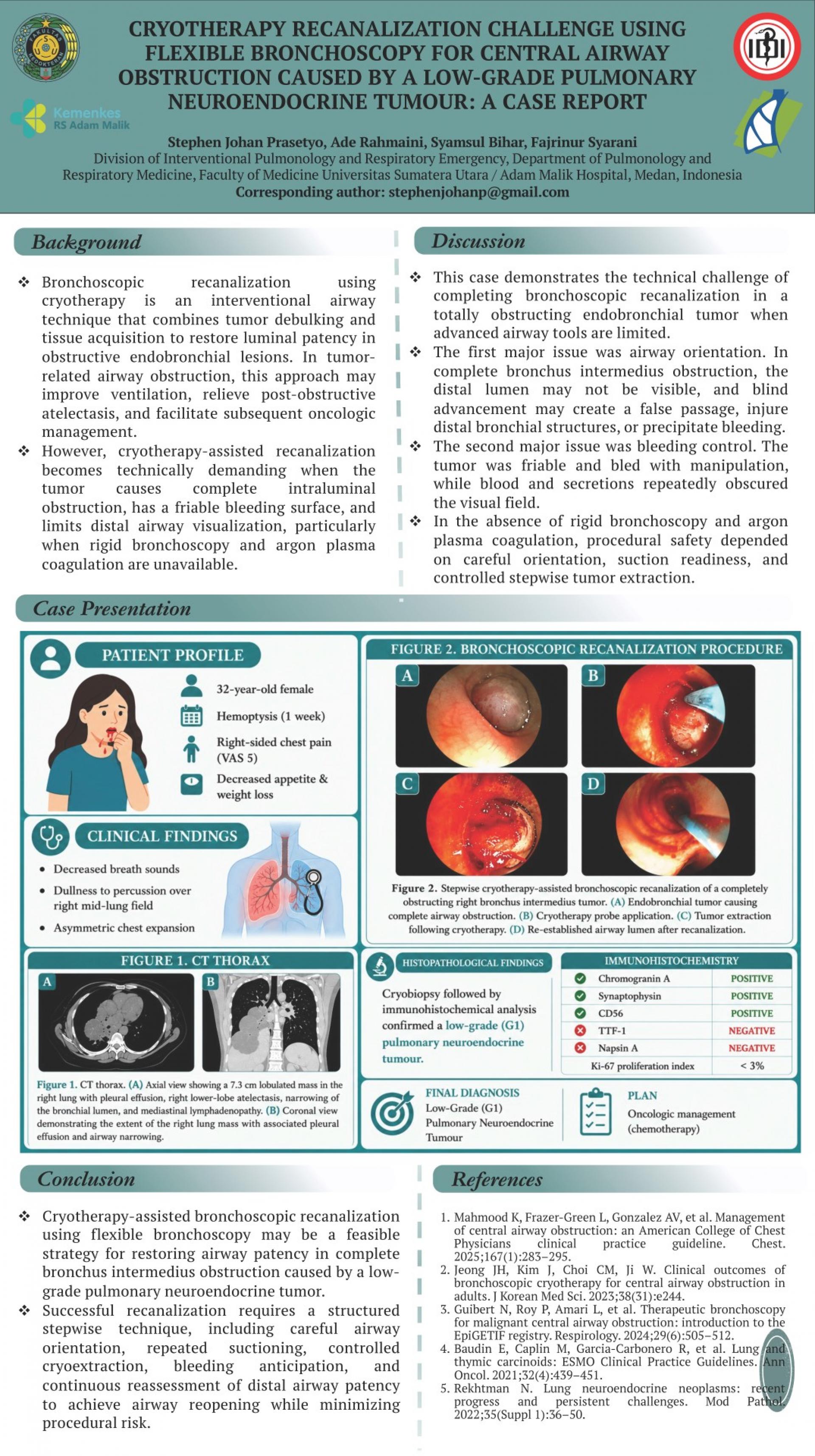 Cryotherapy Recanalization Challenge Using Flexible Bronchoscopy for Central Airway Obstruction Caused by a Low-Grade Pulmonary Neuroendocrine Tumor_ A Case Report