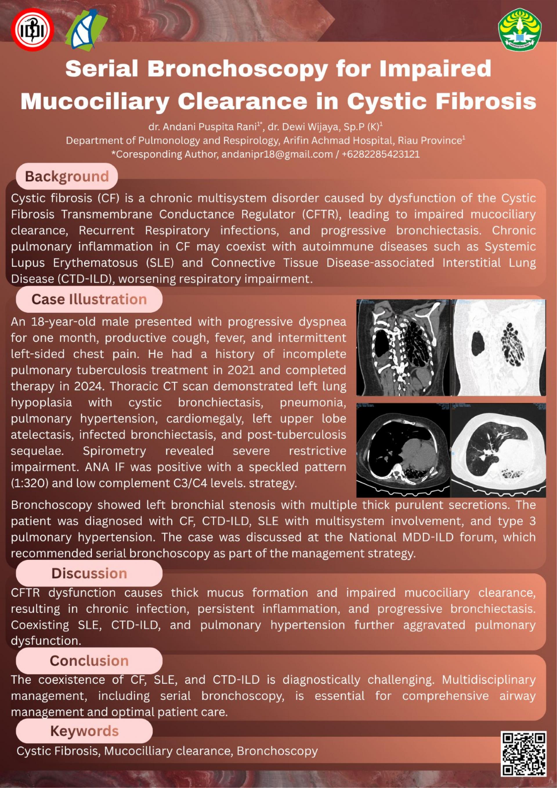 Serial Bronchoscopy for Impaired Mucociliary Clearance in Cystic Fibrosis