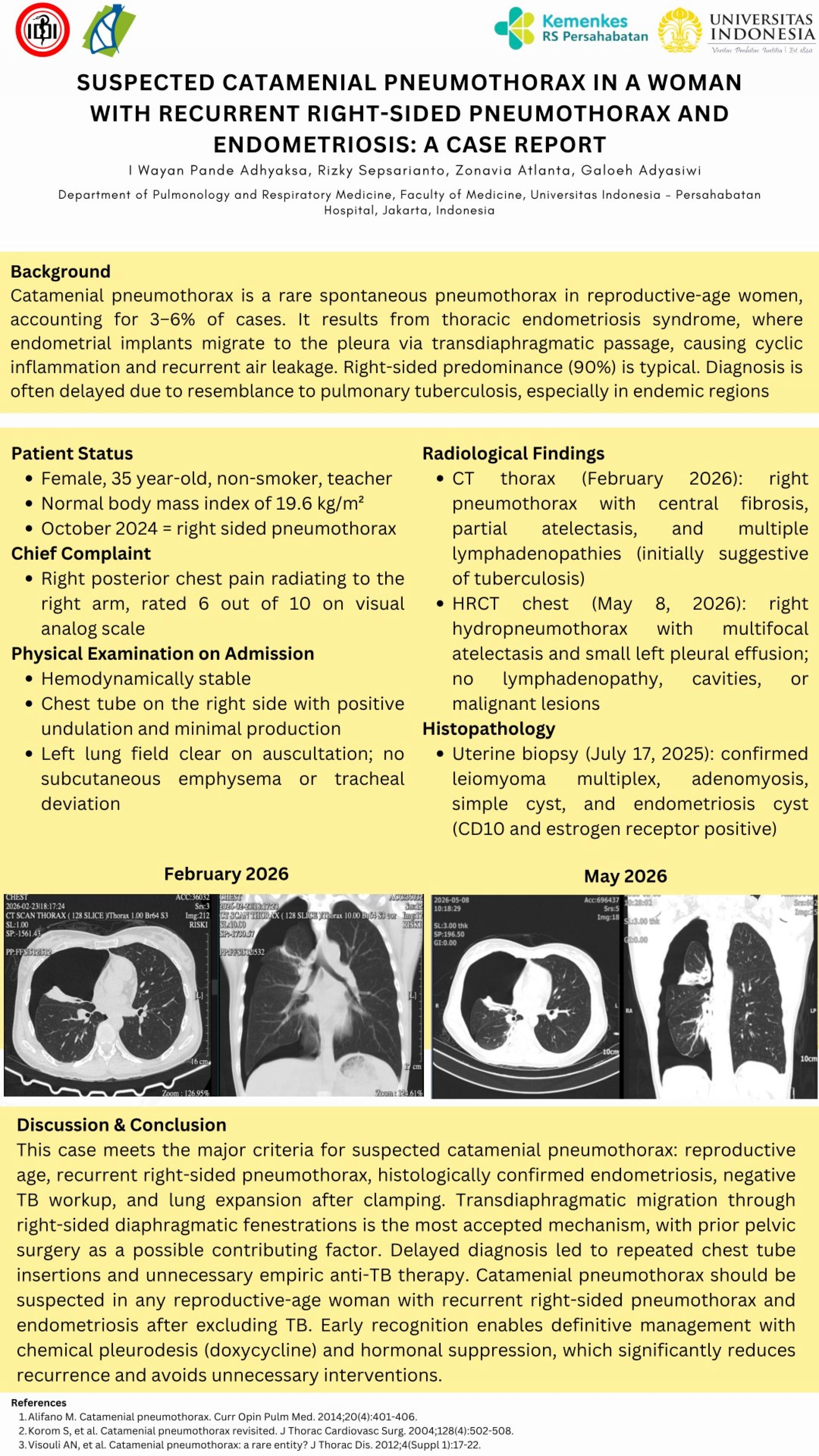 SUSPECTED CATAMENIAL PNEUMOTHORAX IN A WOMAN WITH RECURRENT RIGHT-SIDED PNEUMOTHORAX AND ENDOMETRIOSIS_ A CASE REPORT