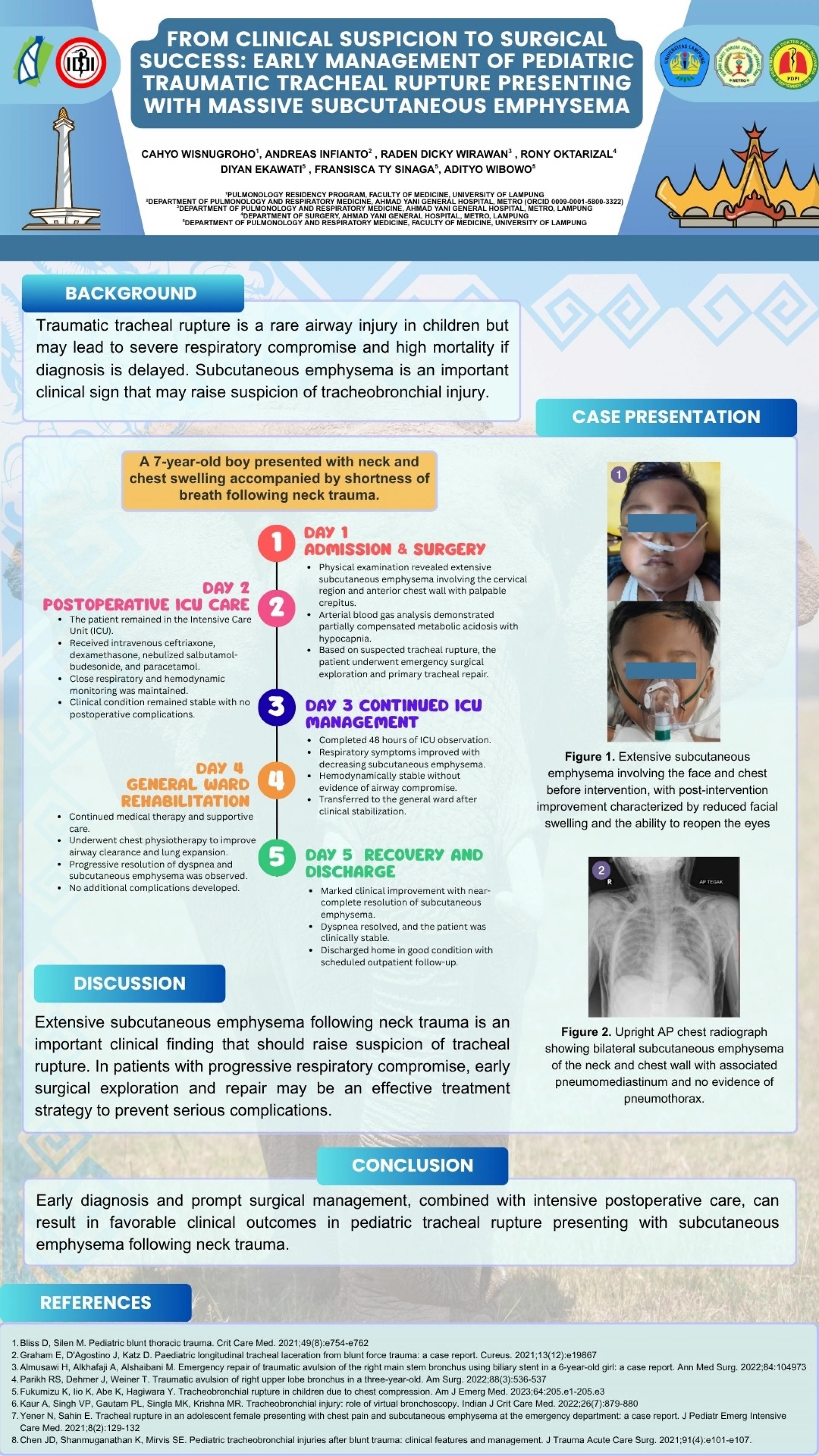 From Clinical Suspicion to Surgical Success_ Early Management of Pediatric Traumatic Tracheal Rupture Presenting with Massive Subcutaneous Emphysema